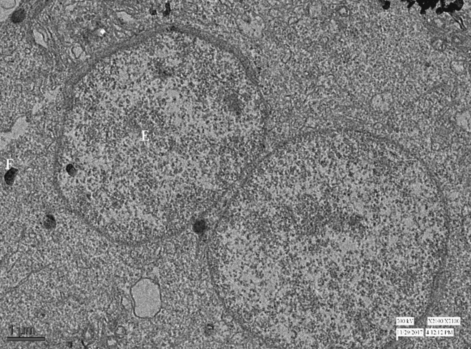 Transmission electron microscopy. The figure shows the nucleus of Sertoli cells with an intact nuclear membrane (E) and dense body in the cytoplasm of fetal germ cells or gonocytes (F).