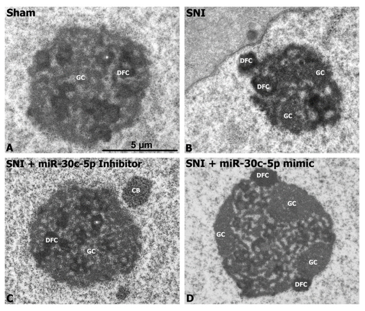 Representative electron micrographs illustrating the ultrastructural nucleolar characteristics of dorsal root ganglia neurons after administration of miR-30c-5p mimic or inhibitor to SNI rats. Sham (A) and SNI rats treated with miR-30c-5p inhibitor (C) exhibit the typical nucleolar organisation of DRG neurons, characterised by the presence of numerous small-sized fibrillar centres (*, FCs), surrounded by a ring of dense fibrillar component (DFC), and areas of granular component (GC), preferentially at the nucleolar periphery. SNI rats treated with vehicle (B) or with miR-30c-5p mimic (D) present severe nucleolar alterations, including the formation of enlarged FCs and segregation of large masses of GC and DFC at the nucleolar periphery. Scale bar: 2 um.
