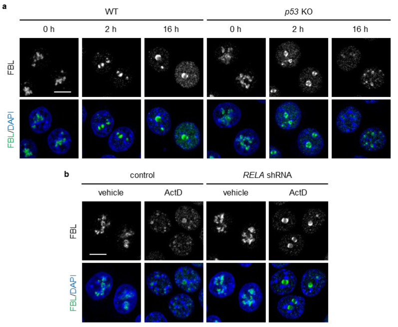RelA knockdown suppressed ActD-induced nucleolar cap disruption and nucleoplasmic FBL localization in p53 KO cells. (a) WT and p53 KO HCT116 cells were treated with or without ActD (20 ng/mL) for 16 h. (b) p53 KO HCT116 cells expressing control or RelA shRNA were treated with or without ActD (20 ng/mL) for 16 h. (a,b) Confocal images of FBL (green) and DAPI-stained DNA (blue). The scale bar is 10 um.