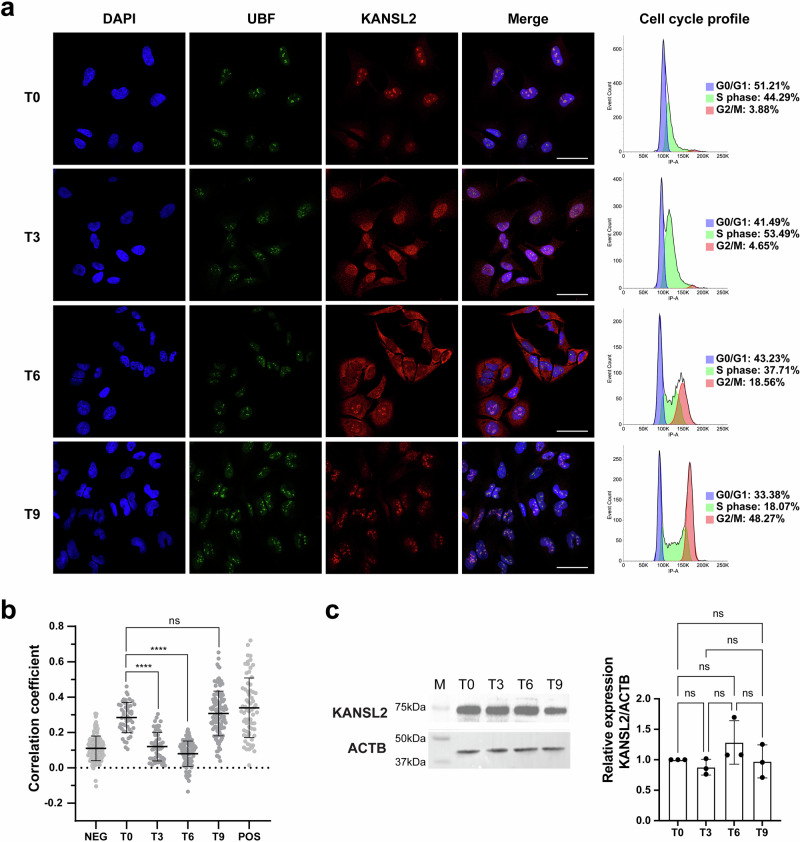 Nucleolar localization of KANSL2 in synchronized cells. a Immunofluorescence detection of endogenous KANSL2 and nucleolar marker UBF in Hela cells. DAPI stained the nuclei. Adjustments to individual channels were performed to better visualize the merged images. (scale bar, 50 μm). Cell cycle was determined through propidium iodide staining and flow cytometry of synchronized cells. b Correlation co