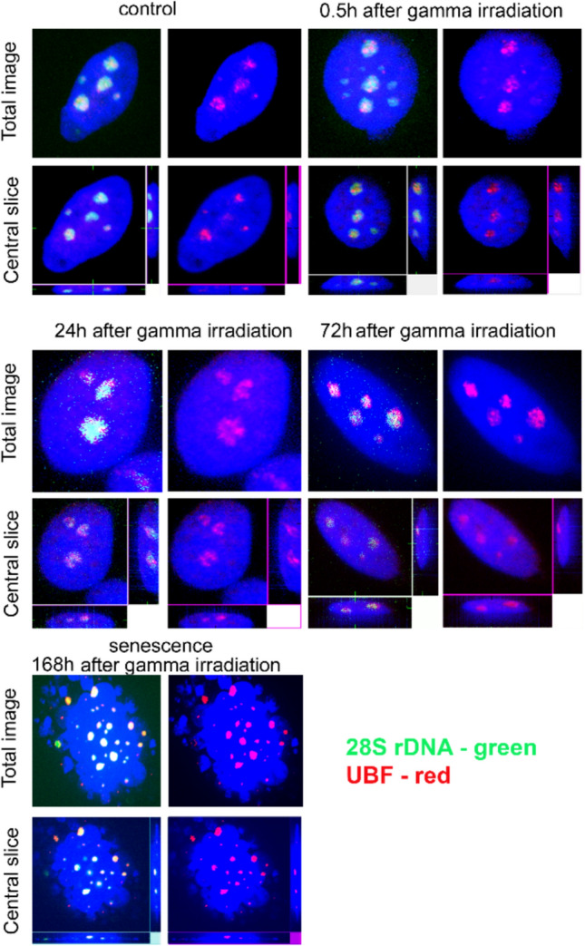 Immunostaining of control and irradiated MCF-7 cells with an antibody to the UBF transcription factor. UBF and 28S rDNA signals are visualized in red and green fluorescence, respectively. Staining of cells was carried out in cycling cells and at different intervals following irradiation