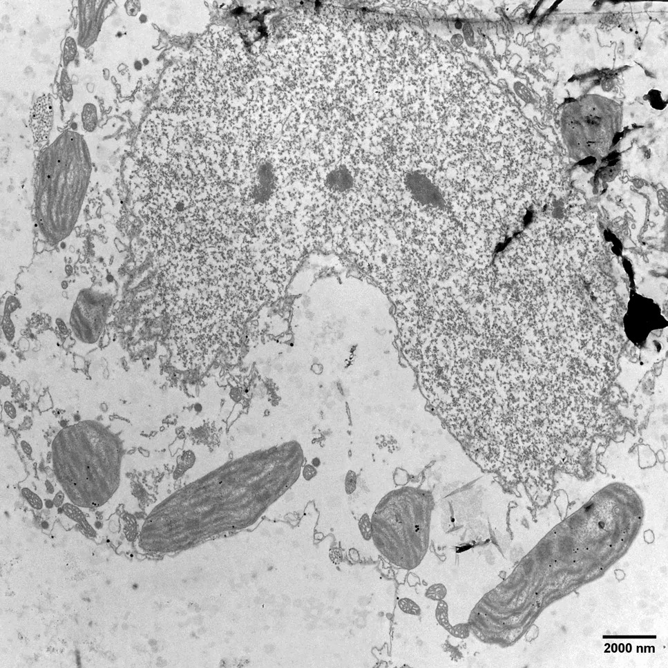 TEM image of a crescent-shaped nucleus in Chara sp