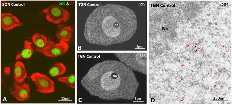 (A) Double fluorescent labeling of the 20S proteasome and propidium iodide (PI) in mechanically dissociated supraoptic neuron (SON) cell bodies from a control rat. Note the high nuclear concentration of the 20S proteasome. Structures, enriched in rRNAs, namely nucleoli and polyribosome-rich cytoplasmic areas (Nissl substance), appear intensely contrasted with PI. (B,C) Immunolabeling illustrating the nuclear and cytoplasmic distribution of the regulatory 19S and catalytic 20S proteasomes in rat trigeminal ganglion neurons (TGN). Note the higher concentration of proteasomes within the nucleus, the existence of nucleoplasmic domains with reduced proteasome signals (white asterisks), and the absence of both 19S and 20S proteasomes within the nucleolus (No). (D) Immunogold electron microscopy detecting the 20S proteasome and showing its localization in euchromatin regions (red arrows). The nucleolus (No) lacks proteasome signal.