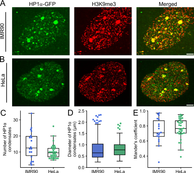 HP1a condensate properties in resting conditions in IMR90 and HeLa. A Airyscan super resolution images of nuclei IMR90 transiently transfected with HP1a-GFP (green), fixed and stained with anti-H3K9me3 (red) antibodies. Merged image shown in the right panel. Scale bar = 2 um. B HeLa cells stably transfected with HP1a-GFP (green), fixed and stained with antibody against H3K9me3 (red). Merged image showing HP1a condensate distribution.