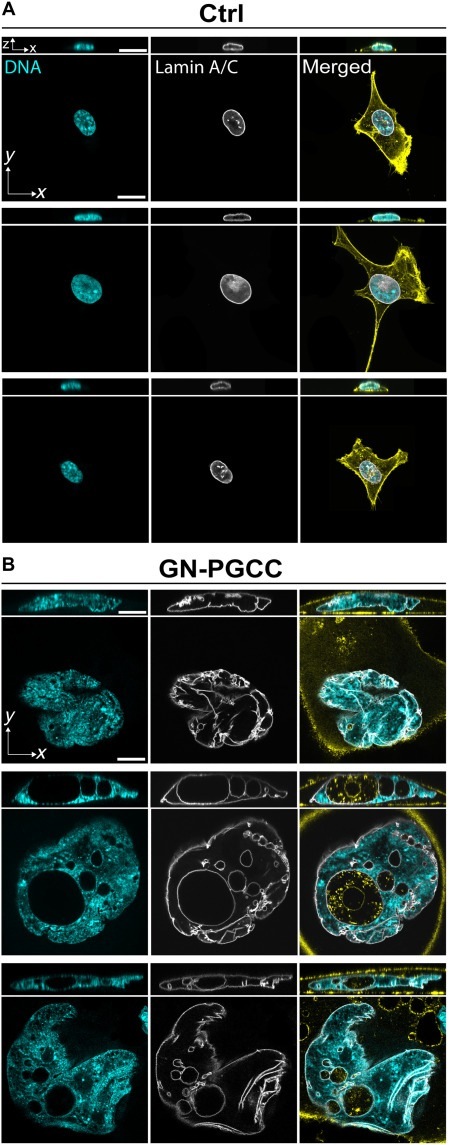 Laminar wrinkling does not reflect a lack of nuclear flattening in GN-PGCCs. Confocal images of (A) HEY control cells and (B) GN-PGCC expressing GFP-Lamin A (gray) cultured on glass. Cells were stained for DNA (cyan), and F-actin (yellow). All scale bars are 20 um.