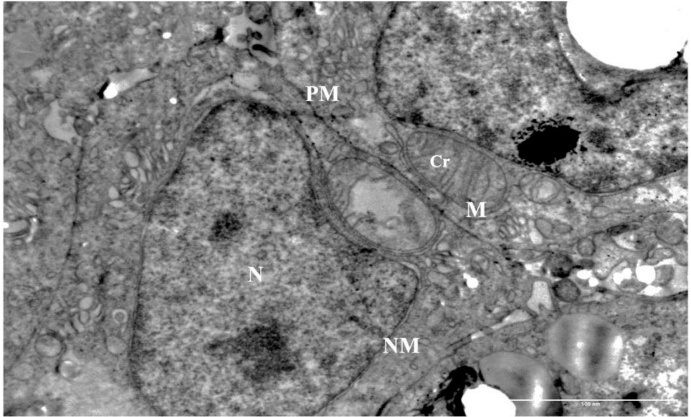 A control Ishikawa spheroid cell by TEM, showing an intact plasma membrane, continuous nuclear envelope, and mitochondria with intact cristae. Scale bar visible at lower right.