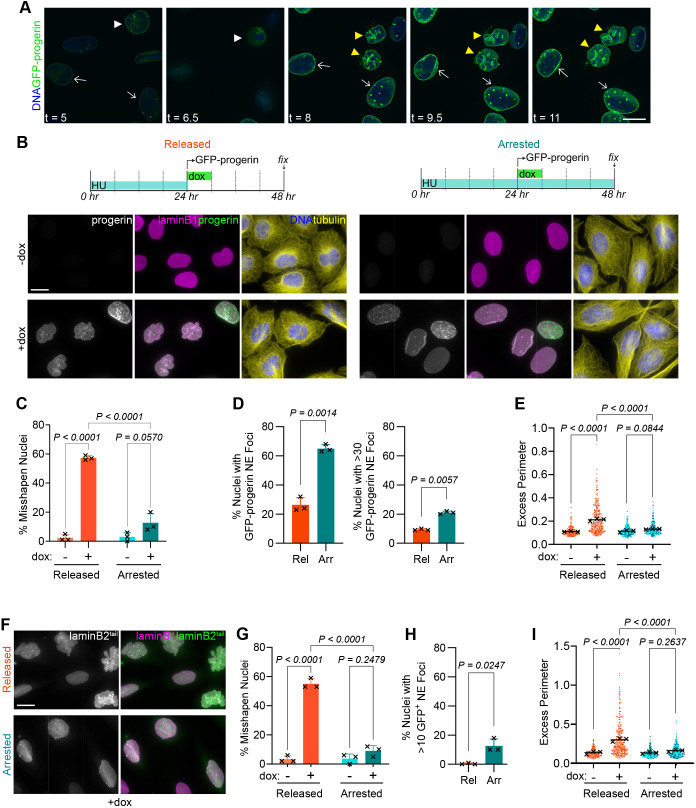 The lobulated nuclear phenotype associated with HGPS is dependent on cell division, with arrested cells displaying a distinct nuclear phenotype. (A) Time-lapse imaging of U2OS cells with doxycycline (dox)-inducible GFP-progerin expression. Cells were incubated with 500 ng/ml dox at t=0. Images were acquired every 30 min for 7 h using a spinning-disc confocal microscope. DNA was visualized using NucBlue.