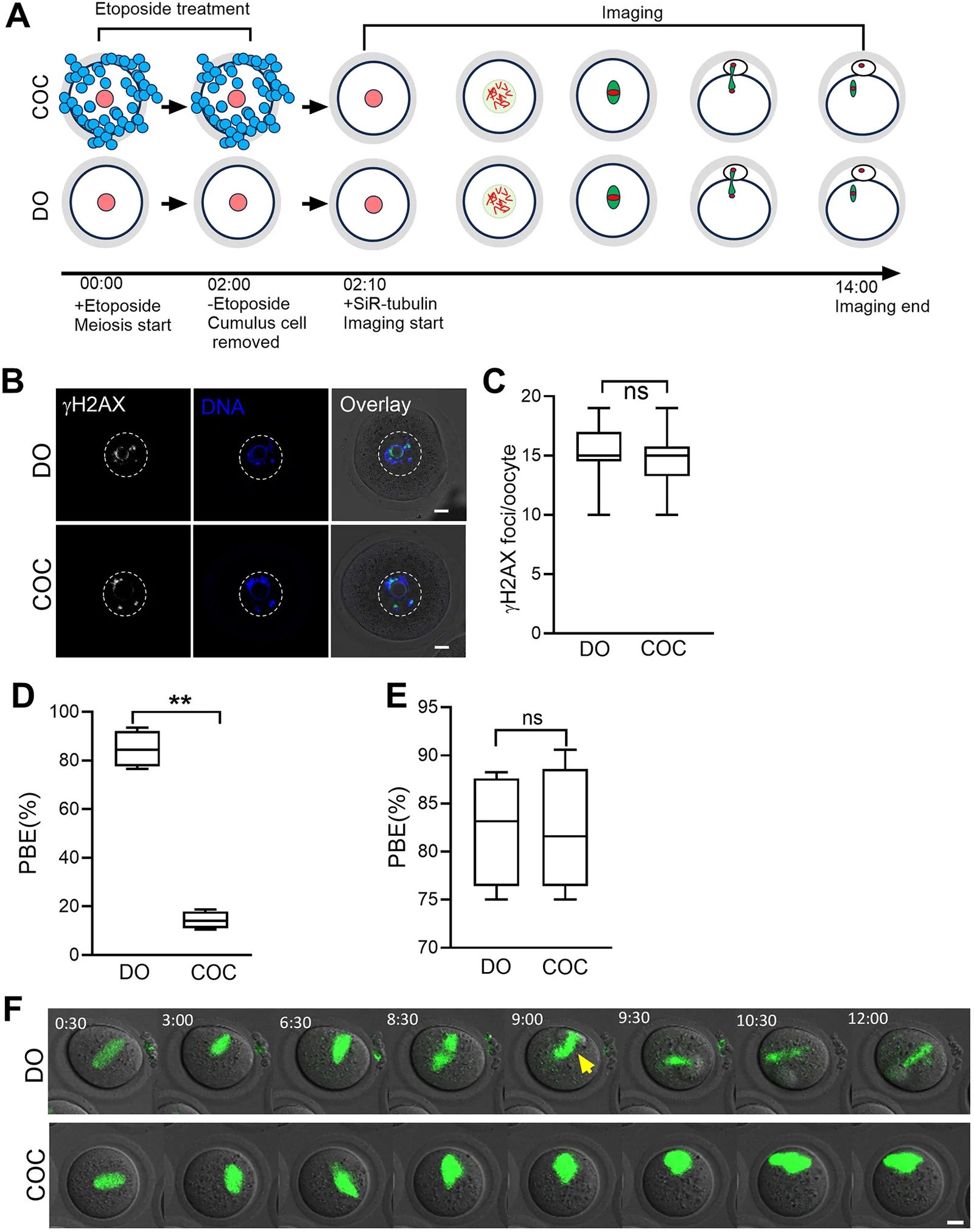 DNA damage causes metaphase arrest of the oocytes from COCs but not DOs. (A) Schematic of meiotic maturation in DOs and COCs treated with 10 ug/ml etoposide for 2 h at meiosis onset. Both groups were cultured in M16 medium with etoposide. After 2 h, cumulus cells in COCs group were removed and etoposide were washed out, followed by SiR-tubulin loading and 12 h time-lapse confocal imaging. Time is indicated as hh:mm post-GV release. (B) Representative gamma-H2AX and DNA labelling in DO and COC oocytes. Scale bars: 10 um. Oocytes were cultured in M16 medium with 10 ug/ml etoposide for 2 h, then fixed and stained with gamma-H2AX antibody and Hoechst. Dashed circles indicate the germinal vesicle location. n=4 independent experiments, with a total of 20 COC oocytes and 21 DO oocytes analysed. (C) gamma-H2AX foci per oocyte in COCs and DOs after 2 h etoposide treatment. Data are presented as box-and-whisker plots. n=4 independent experiments, with a total of 20 COC oocytes and 21 DO oocytes analysed. ns, not significant (two-tailed paired Student's t-test). (D) PBE rates of DO and COC oocytes after 2 h treatment with 10 ug/ml etoposide at maturation onset. Cumulus cells in COCs were removed after 2 h, then cultured in normal M16 for 12 h. Data are presented as box-and-whisker plots. n=4 independent experiments, with a total of 91 COC oocytes and 75 DO oocytes analysed. **P<0.01 (two-tailed paired Student's t-test). (Fig. 2.)