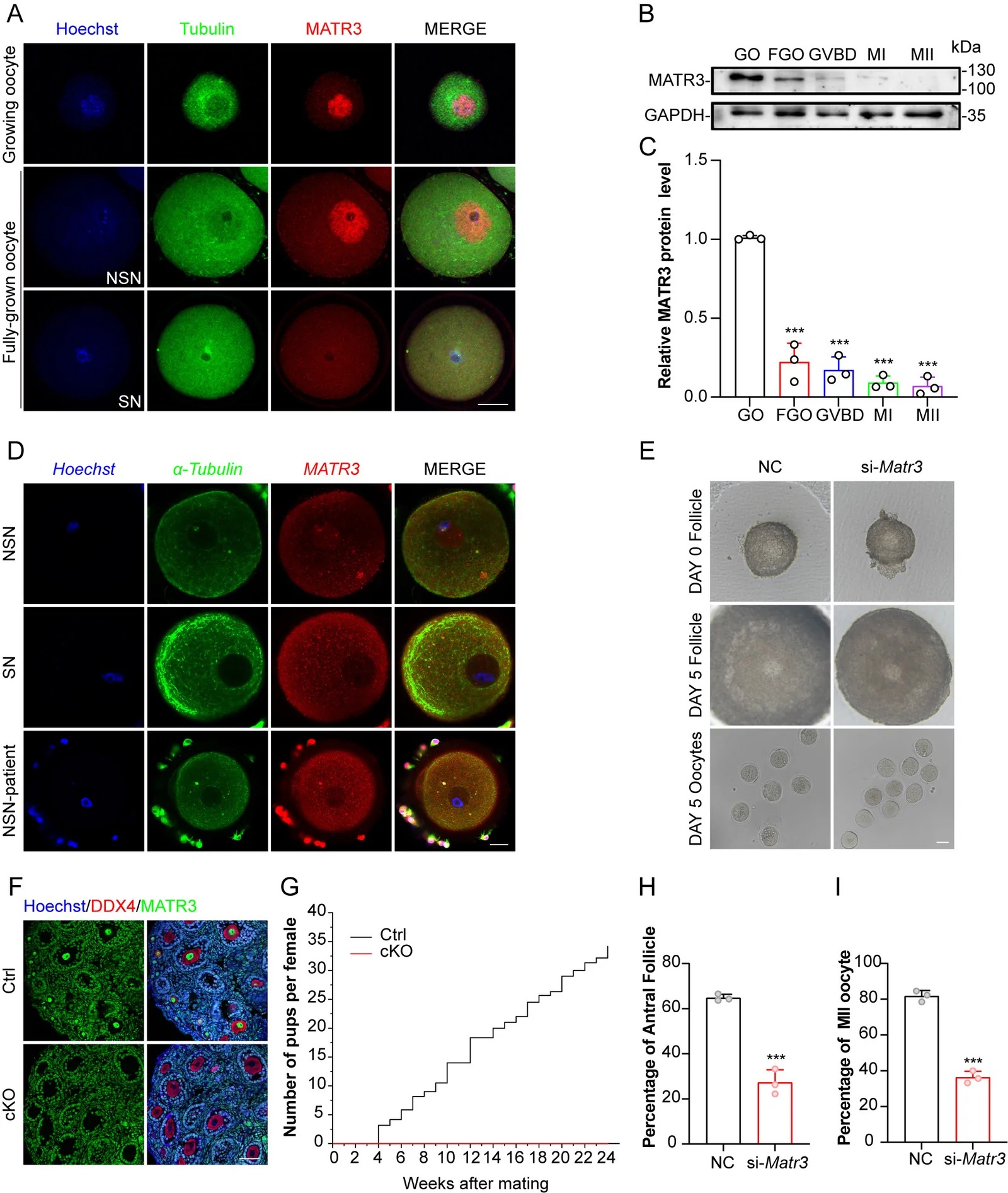 MATR3 in growing oocyte regulates female reproduction in mice. (A) Immunofluorescence showing MATR3 levels in mouse oocytes. (B) Western blot results showing MATR3 expression in mouse oocytes. Total proteins from 200 oocytes were loaded in each lane. GAPDH served as a loading control. (C) Relative expression level of MATR3 to GAPDH. (D) Immunofluorescence showing MATR3 levels in human oocytes. n=11. (E) Representative image of follicles and oocytes from negative control (NC) and si-Matr3. (F) Immunohistochemistry results showing MATR3 expression in oocytes. (G) Cumulative number of pups from Ctrl (n=6) and cKO (n=3) female. (H) Percentage of antral follicles in E. n>=33 per group. (I) MII ratio of oocytes collected from E. n>=33 per group. Scale bars: 20 um in (A), (B), and (C), 40 um in (E) and (F). Data are represented as mean +/- SD. ***p<0.001, **p<0.01, *p<0.05, n.s., not significant. (Figure 1..)