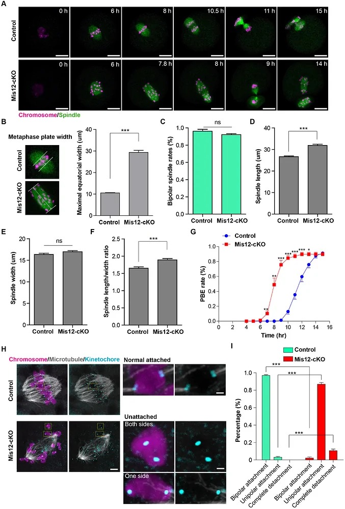 MIS12 is required for K-MT attachment in mouse oocytes. (A) Representative time-lapse images of control and Mis12-deleted oocytes expressing EGFP-MAP4 (microtubules, green) and H2B-mCherry (chromosomes, magenta), captured over 15 h with a frame interval of 10 min. Scale bar: 20 um. (B) MIS12 deletion disrupts chromosome alignment. Quantification of the maximal equatorial chromosome width in meiosis I shows significant widening in mutant oocytes (n = 23) compared with control oocytes (n = 30). Data are presented as mean +/- SEM. (C) Analysis of spindle bipolarity at metaphase I in control (n = 47) and Mis12-cKO (n = 63) mouse oocytes. (D) Analysis of spindle length at metaphase I in control (n = 39) and Mis12-cKO (n = 52) mouse oocytes. (E) Analysis of spindle width at metaphase I in control (n = 39) and Mis12-cKO (n = 52) mouse oocytes. (F) Analysis of the spindle length/width ratio at metaphase I in control (n = 39) and Mis12-cKO (n = 52) mouse oocytes. (G) Mis12 deletion accelerates meiosis I progression (control, n = 138; Mis12-cKO, n = 152). (mouse (control and Mis12-cKO mouse oocytes at meiosis I metaphase and progression); FIGURE 2.)