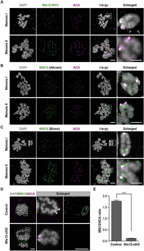 MIS12 localizes to kinetochores in mouse oocytes. (A) Exogenous MIS12 robustly localizes to kinetochores during both meiosis I (n = 13) and meiosis II (n = 12). Oocytes were immunostained with anti-MYC and anti-ACA antibodies, DNA is counterstained with DAPI. Three independent experiments were conducted. (B) Endogenous MIS12 clearly localizes to kinetochores in meiosis I (n = 15) and meiosis II (n = 13), as validated using antibody from Abcam. Three independent experiments were conducted. (C) Endogenous MIS12 clearly localizes to kinetochores in meiosis I (n = 11) and meiosis II (n = 14), as validated using antibody from Bioss. Three independent experiments were conducted. (D) MIS12 signal is absent from kinetochores in Mis12-deleted oocytes. Oocytes after spreading were immunostained with anti-MIS12 (Abcam) and anti-ACA antibodies. DNA is counterstained with DAPI (Applies to A-D). Scale bars: 10 um (overview), 5 um (enlarged view) (Applies to A-D). Three independent experiments were conducted. Three independent experiments were conducted. (E) Quantification of the MIS12/ACA ratio from (D) in control (n = 145) and Mis12-deleted (n = 148) oocytes. Data are presented as mean +/- SEM; *** p < 0.0001. The number of kinetochores analyzed (n) is indicated. (FIGURE 5.)