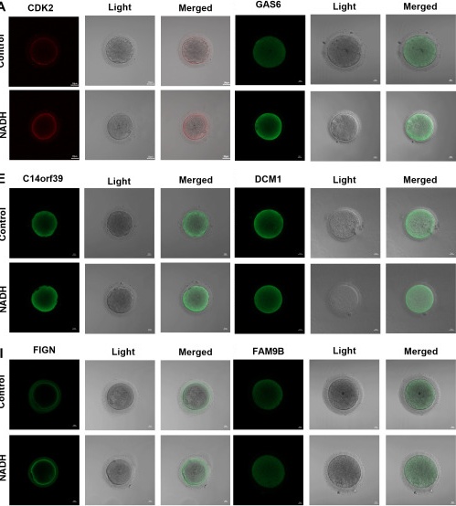 Fluorescence images of human IVM-MII oocytes by laser confocal microscopy. Scale bar, 20 um. (A) Effect of NADH on CDK2 in IVM-MII oocytes. (C) Effect of NADH on GAS6 in IVM-MII oocytes. (E) Effect of NADH on C14orf36 in IVM-MII oocytes. (G) Effect of NADH on DCM1 in IVM-MII oocytes. (I) Effect of NADH on FIGN in IVM-MII oocytes. (K) Effect of NADH on FAM9B in IVM-MII oocytes. Each panel shows immunofluorescence channel, brightfield, and merged overlay for control and NADH-treated oocytes. Adapted: micrograph panels A, C, E, G, I and K rearranged side by side; bar chart panels removed. (human (IVM-MII oocytes); Figure 7, panels A, C, E, G, I, K (confocal IF micrographs only; bar chart panels B, D, F, H, J, L excluded; left group cols 5-257 and right group cols 420-664 of full figure, stitched).)