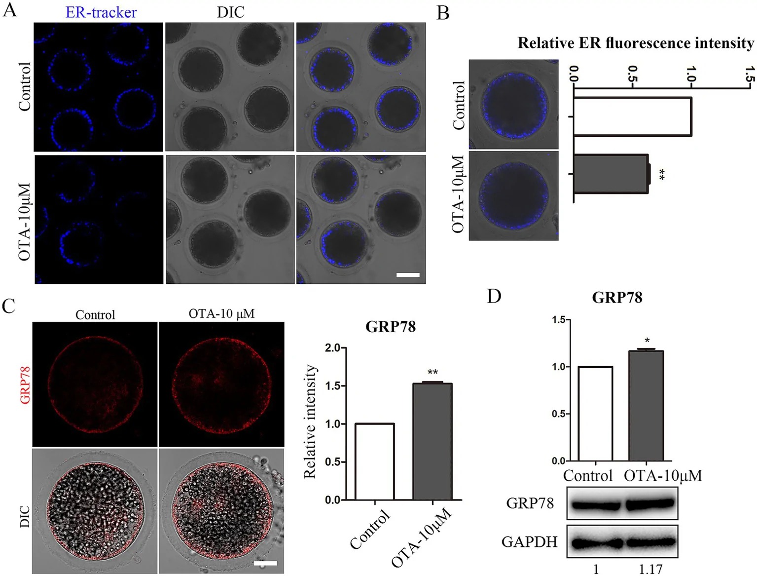 OTA induces GRP78-based ER stress in porcine oocytes. (A) Endoplasmic reticulum fluorescence staining showed that the fluorescence of treatment group was significantly decreased. Blue, endoplasmic reticulum. Bar = 50 um. (B) The results of statistical analysis showed that the intensity of endoplasmic reticulum in treatment group was significantly reduced. **p < 0.01. (C) GRP78 fluorescence staining results showed that the fluorescence of treatment group was obviously higher. Red, GRP78. Bar = 20 um. Statistical analysis results showed that the fluorescence of GRP78 in treatment group increased significantly. **p < 0.01. (D) Western Blot analysis of GRP78 protein expression in the control and treatment groups. *p < 0.05. (Figure 2.)