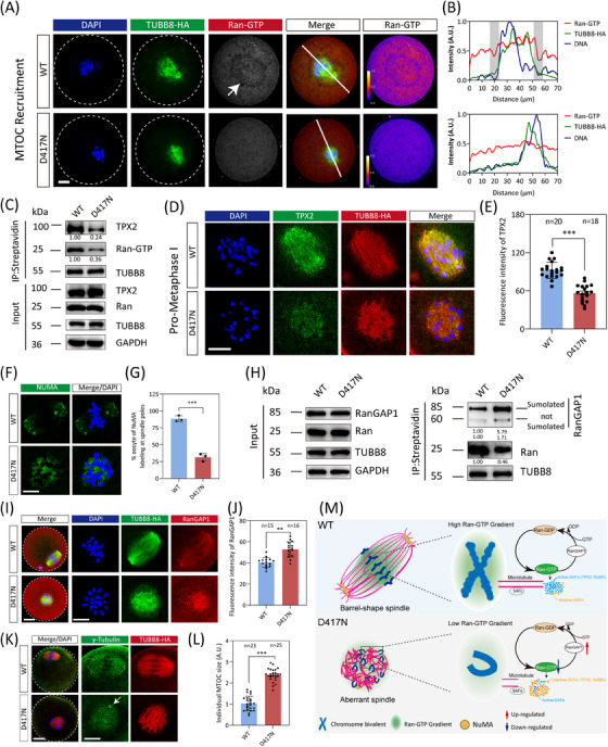 Defective spindle assembly caused by perturbed Ran-GTP pathway in TUBB8 D417N oocytes. (A) Representative immunofluorescence images of mouse oocytes at MTOC recruitment stages of meiosis. Green, microtubule (TUBB8-HA); red, active-Ran (Ran-GTP); blue, DNA (DAPI). The dashed line demarcates the oocyte. Right panels showing LUT colour grading according to intensity of the Ran-GTP. (B) Intensity profiles along the white lines are shown for oocytes at the MTOC recruitment stage. The shaded box represents the Ran-GTP gradient in WT oocyte. (C) Co-immunoprecipitation was performed to determine the decreased affinity between TUBB8 and Ran-GTP or TPX2 by the D417N missense variant. The immunoblots of protein precipitants were probed with Ran-GTP, TPX2, and streptavidin (TUBB8) antibodies. (D) Representative immunofluorescence images of mouse oocytes at the Pro-MI stage. Green, TPX2; red, microtubule (TUBB8-HA); blue, DNA (DAPI). Scale bars, 10 um. (E) Quantitative analysis of the mean intensity of TPX2 (*** p < .001 by Unpaired Student's t-test). Numbers indicate the individual oocytes quantified. (F) Representative immunofluorescence images of mouse oocytes at MI stage. Green, NuMA; blue, DNA (DAPI). Scale bars, 10 um. (G) Quantitative analysis of the percentage of oocytes with NuMA labelling at spindle poles (*** p < .001 by unpaired Student's t-test). (H) Co-immunoprecipitation was performed to determine the increased affinity between TUBB8 and RanGAP1 by the D417N missense variant. The immunoblots of protein precipitants were probed with RanGAP1 and streptavidin (TUBB8) antibodies. (I) Representative immunofluorescence images demonstrating spindle assembly in mouse metaphase I oocytes from WT and D417N. Green, microtubule (TUBB8-HA); red, RanGAP1; blue, DNA (DAPI). Scale bar, 10 um. (J) Quantitative analysis of the mean intensity of RanGAP1 (*** p < .001 by unpaired Student's t-test). Numbers indicate the individual oocytes. (K) Representative immunofluorescence images demonstrating spindle assembly in mouse metaphase I oocytes from WT and D417N females. Green, gamma-Tubulin; red, microtubule (TUBB8-HA); blue, DNA (DAPI). Scale bar, 10 um. The white arrow indicates the unfragmented MTOC. (L) Quantification of individual MTOC size (Unpaired Student's t-test, two-tailed, *** p < .001). Numbers indicate the individual oocytes quantified. (mouse (oocytes from wild-type and TUBB8-D417N conditional knockin mice at meiosis I stages); Figure 4.)