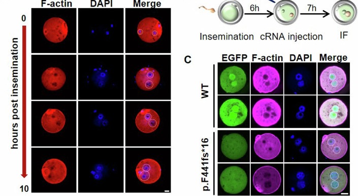 Immunofluorescence staining of F-actin with phalloidin and DNA with DAPI, depicting the F-actin meshwork in zygotes at different hours post insemination. Scale bar: 20 µm. The white dashed circle indicates pronuclei. (human; Figure 2, panel A (IF of human zygotes at multiple hours post insemination; rows 17-404 of figure).)