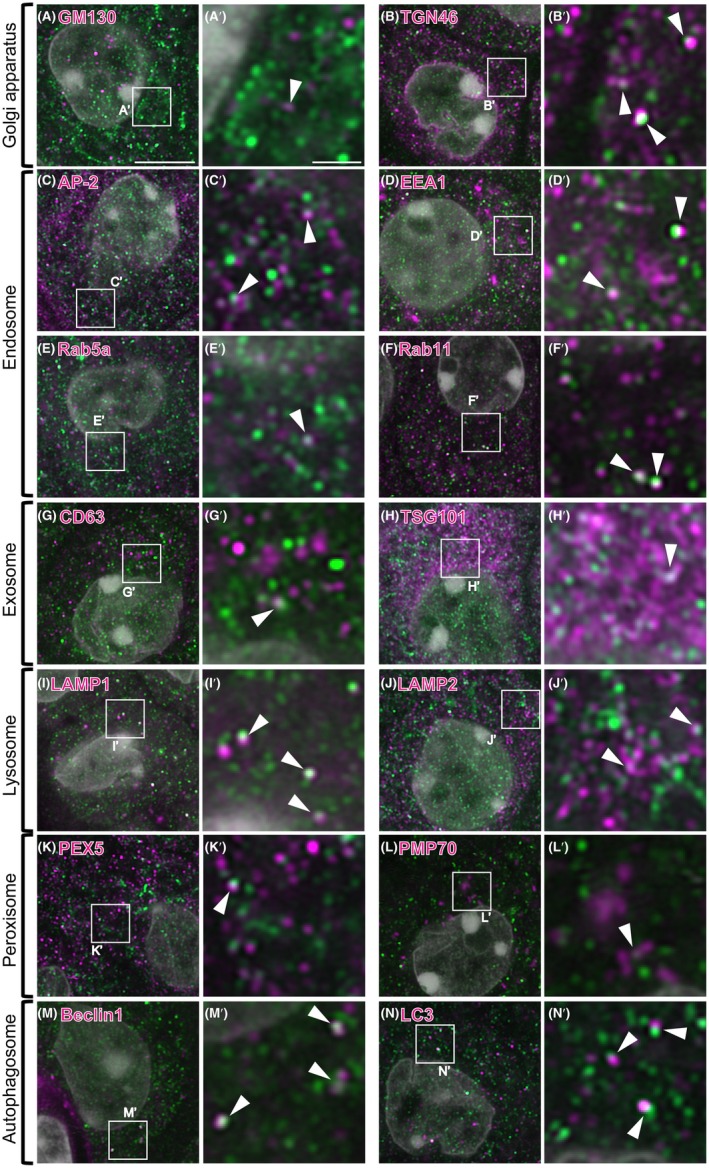 Panel I (LAMP1): lysosome marker as magenta puncta, inset with arrowheads. composite of 14 immunofluorescence panels, mouse choroid plexus epithelial cells; magenta channel is the named organelle marker