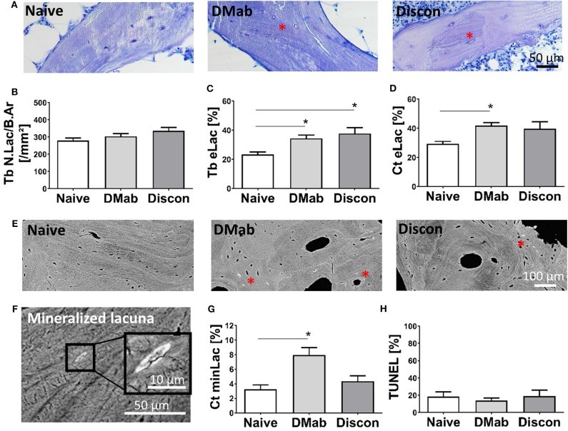 Osteocyte network characteristics in human bone biopsies. Representative toluidine blue stained histological images of trabecular bone. Viable osteocyte lacunae with cell nuclei are evident in the bone matrix. Both treatment-naive patients and those after denosumab therapy are shown, demonstrating the osteocyte lacuno-canalicular network in trabecular human iliac crest bone. (Homo sapiens; Figure 4.)