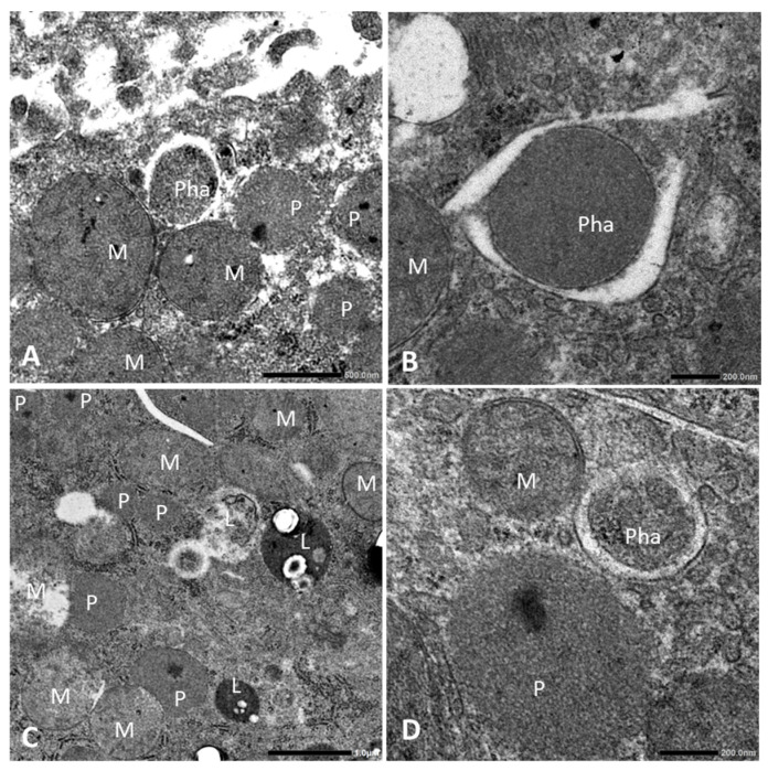 Representative TEM images of peroxisome and phagophores of hepatocytes. (A,B) Peroxisomes (P), mitochondria (M), and phagophore (Pha) in the CF group. An organelle, possibly peroxisome captured by phagophore (sequestered membranes), indicating phagophore expansion. (C,D) Peroxisomes, mitochondria, phagophore, and autolysosomes (L) in the HFD + CF group. Autolysosomes consist of organelles and lysosomes. TEM, transmission electron microscopy. Bar = 200 (B,D), 500 nm (A) and 1.0 µm (C). (rat (hepatocyte, clofibrate-treated and HFD+clofibrate-treated groups); Figure 3, full figure (panels A-D; peroxisomes labeled P).)