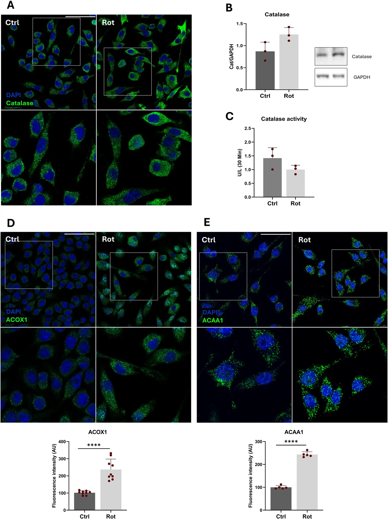 Rotenone effect on catalase and beta-oxidation pathways. (A) Representative confocal microscopy images of BV2 cells treated with vehicle (Ctrl, DMSO) or 50 nM Rot for 24 h and stained for catalase. DAPI was used for nuclear counterstaining. Higher-magnification views of the boxed regions are shown in the panel below to better visualize the intracellular staining pattern. Magnification: 40x. Scale bar = 50 um.