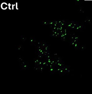 PMP70-positive peroxisomes (green) in an untreated control BV2 cell, single-channel crop from a larger comparison figure on rotenone and peroxisomal remodeling. Scale bar 10 um in the original.