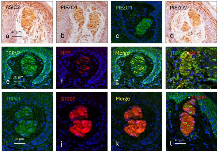 Immunohistochemical and immunofluorescence detection of selected mechanosensitive ion channel-related proteins (Piezo1, Piezo2, TRAAK) in Meissner corpuscles of human glabrous skin. Meissner corpuscles — encapsulated mechanoreceptors in the dermal papillae of plantar and palmar skin — show immunoreactivity for ion channel proteins. Note the characteristic elongated lamellated structure of each corpuscle. (Homo sapiens; Figure 1.)