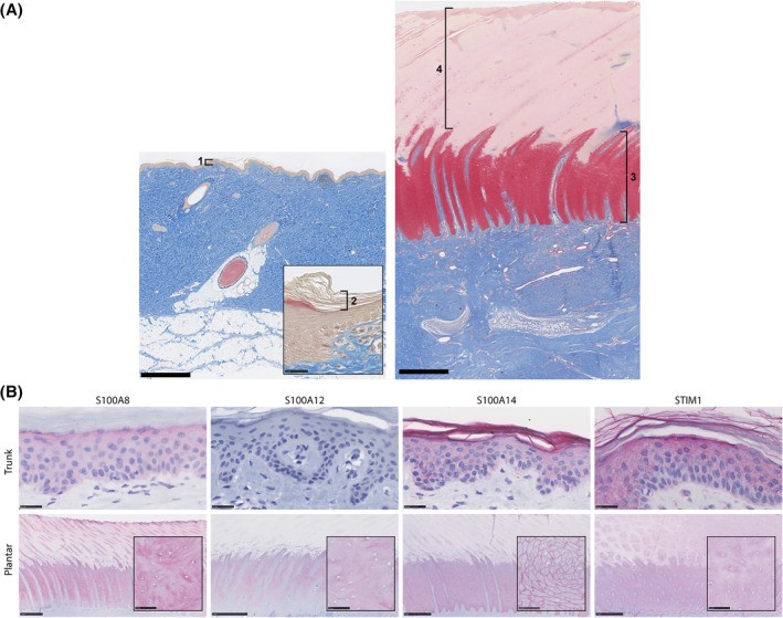 Volar characteristics recapitulated in ectopic graft sites. Masson's trichrome-stained volar MSTC (microcolumn skin tissue constructs) graft tissue sections at various timepoints after engraftment, demonstrating persistent volar characteristics including a thickened stratum corneum, acanthotic epidermis and collagen-rich dermis. Panels show how volar (plantar) skin structure with its characteristic thick epidermis and dense collagen bundles compares to non-volar skin. (Homo sapiens; Figure 4.)