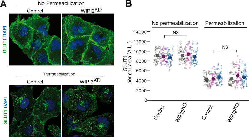 GLUT1 expression and localization upon WIPI2 knockdown. (A) GLUT1 cell surface exposure. Control and WIPI2KD cells were fixed and stained with antibody against GLUT1 and with DAPI. Where indicated, cells had been permeabilized with 0.05% saponin before staining to reduce plasma membrane staining and provide better access to GLUT1 inside the cell. Scale bars: 10 um.