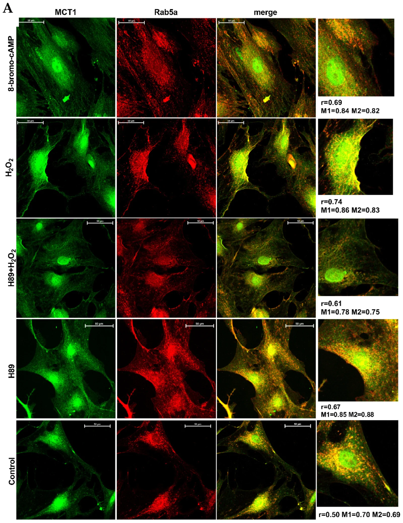 Changes in PKA activity affect caveolin-dependent membrane translocation of MCT1 in podocytes. (A) Immunofluorescent co-staining of MCT1 and Rab5a in podocytes. (B) Immunofluorescent staining of MCT1 and caveolin-1 in podocytes. r--Pearson's correlation coefficient; M1, M2--Manders' overlap coefficients. Cells were treated with 8-bromo-cAMP (100 uM, 5 min), H2O2 (100 uM, 5 min), H89 (10 µM, 1 h), or H2O2 + H89. Scale bar is 50 µm.