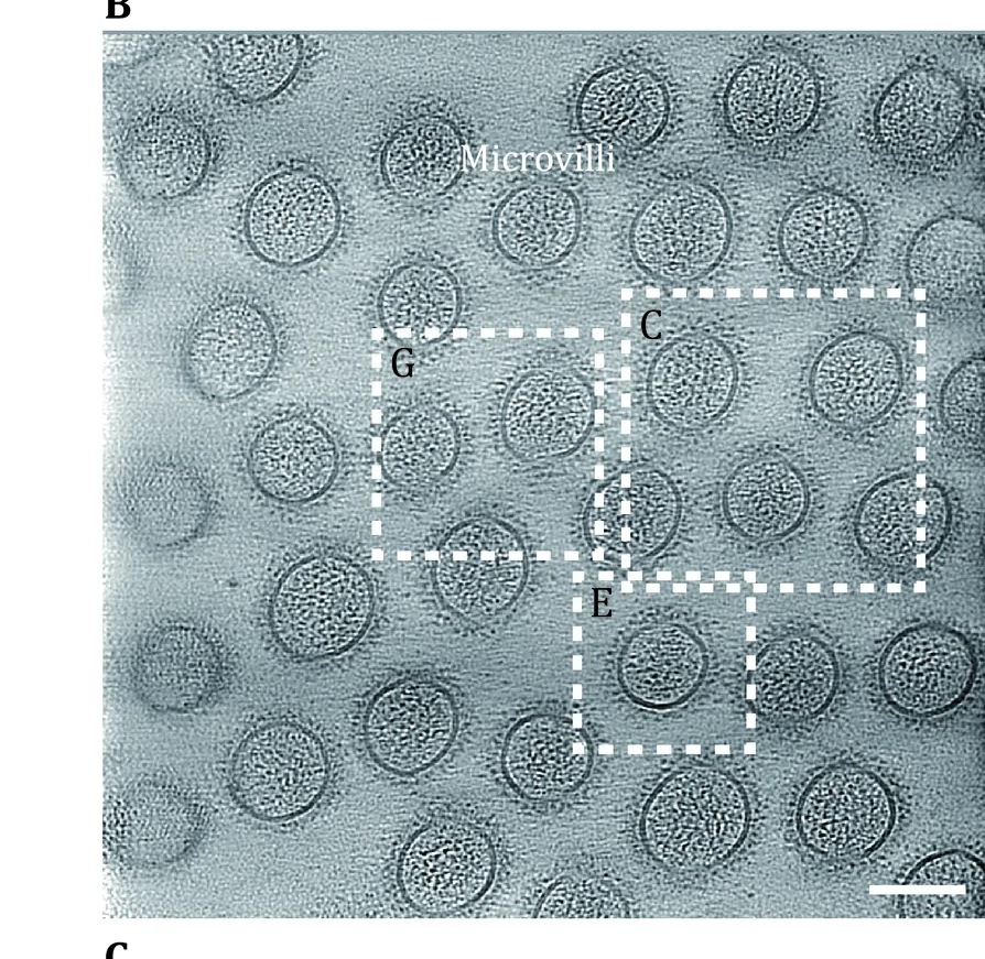 In situ cryo-electron tomography of microvilli on a mouse intestinal epithelial cell, cross-section showing actin bundles in the core and protein densities on the membrane surface, boxed regions magnified elsewhere in the source figure. Scale bar 100 nm.
