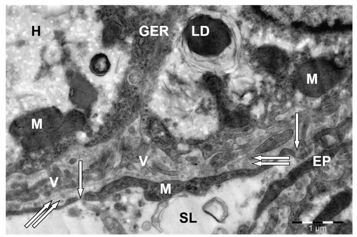 Vascular (sinusoid) side of a hepatocyte (H) in camel liver. V--hepatocyte villi; M--mitochondria; GER--granular endoplasmic reticulum channels; LD--lipid droplet; EP--endothelial cell processes; endothelial cell pores (↑); perisinusoidal space of Disse (↑↑); SL--sinusoid lumen. Electron microphotography. (Bactrian camel (Camelus bactrianus, liver hepatocyte); Figure 4single.)