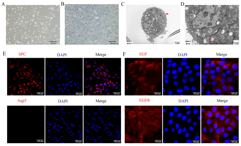 Isolation, culture, and characterization of yak primary AT2 cells. ( A ) Morphological characterization of primary yak AT2 cells following 72 h of in vitro cultivation. ( B ) The cultured AT2 cells exhibited a cobblestone-like morphology on the 6th day. ( C , D ) Identification of AT2 cells was performed using transmission electron microscopy. The thick red arrows indicate the microvilli on the surface of AT2 cells, while the thin red arrows indicate osmiophilic multilamellar bodies. ( E ) AT2 cells were identified through immunofluorescence detection, visualizing the presence of the AT2-marker protein SPC while simultaneously confirming the absence of the AT1-marker protein Aqp5. The nucleus was stained blue with DAPI. ( F ) The presence of EGF and EGFR in AT2 cells was ascertained through immunofluorescence staining. The nucleus was stained blue with DAPI. (Figure 1.)