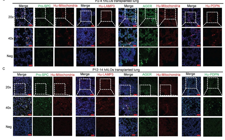 Representative immunofluorescence labeling of AT2 marker pro-SPC (green), Hu-Mitochondria (red/MAB1273), Hu-LAMP3, AGER, and Hu-PDPN in transplanted P2-4 hALOs (panels B, upper) and P12-14 hALOs (panels C, lower). Micrographs shown at 20x and 40x with negative controls. Scale bars, 100 um (20x panels), 50 um (40x panels). (human (iPSC-derived alveolar organoids in mouse lung); Figure 4, panels B and C (confocal IF micrographs; schematic panel A and dot-plot panel D excluded; rows 104-571 of full figure).)