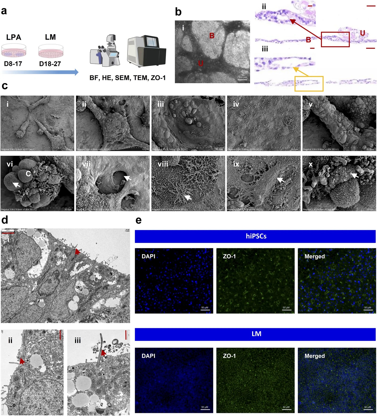 Morphological, ultrastructural, and barrier function characterization of the multi-lineage lung model (LM). (a) Schematic workflow of differentiation from lung progenitors to the multi-lineage model and characterization. (b) Bright-field images and H&E-stained longitudinal sections of day-27 models. Red arrow: duct-like lumina; yellow arrow: alveolus-like cavities; B: basal layer; U: upper layer. Bright-field scale bar: 200 um; H&E scale bars: left 50 um, right 10 um. (c) Scanning electron microscopy (SEM) images showing surface topography and cellular diversity. (i-iv) Overall surface morphology of the model; (v) branched ridges and undulating textures; (vi) surface spherical cell clusters and microvilli-like protrusions; (vii) pore-like cavities; (viii) cells with ciliary structures; (ix) spindle-shaped cells and interwoven fibrous network; (x) cells with surface undulating membrane ruffling characteristics. Arrows: microvilli-like protrusions (vi), pore-like cavities (vii), cilia (viii), fibroblasts (ix), membrane ruffling (x); C: spherical cell clusters. Scale bars: 200, 100, 50, 20, 50, 30, 30, 10, 10, and 10 um, respectively. (d) Transmission electron microscopy (TEM) images. Arrows: microvilli (i), tight junctions, cilia (iii); scale bars: 2, 1, and 1 um, respectively. (e) ZO-1 immunofluorescence staining. Scale bar: 50 um. (FIGURE 2.)