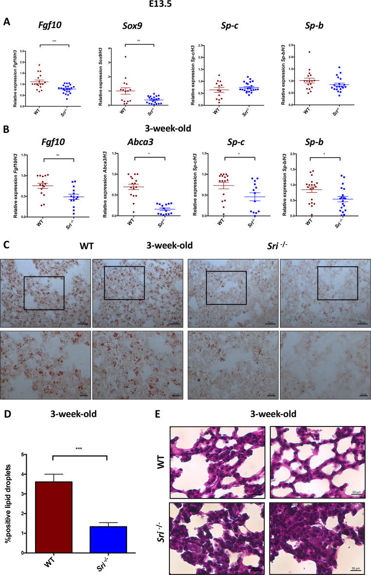 Impaired branching morphogenesis and surfactant production in Sri-/- mice lungs. (A) E13.5 lung tissue: Embryonic Sri-/- mice show significantly decreased expression of branching morphogenesis genes (Fgf10, Sox9), compared to WT mice. Surfactant genes (Sp-b, Sp-c) exhibit no significant difference between the two groups at this stage. (B) 3-week-old lung tissue: significantly reduced expression of surfactant genes (Sp-b, Sp-c), and of the phospholipid transporter Abca3 is observed in Sri-/- mice compared to WT controls. Data are presented as mean +/- SEM. *p < 0.05; **p < 0.01; ***p < 0.001 (determined by Student's t-test). (C) Oil Red O staining of lung sections from 3-week-old WT and Sri-/- mice: Sri-/- mice exhibit decreased lipid droplet accumulation, indicative of impaired total lipid surfactant content, compared to WT. Scale bars, 20 and 50 um. (D) Quantification of lipid droplets from Oil Red O stained sections. Data are presented as mean +/- SEM. ***p < 0.001 (Student's t-test). (E) Periodic acid-Schiff (PAS) staining of lung sections from 3-week-old WT and Sri-/- mice. Sri-/- mice show increased glycogen staining, indicative of pneumocyte immaturity, compared to WT. Scale bars, 50 um. (Fig. 2.)