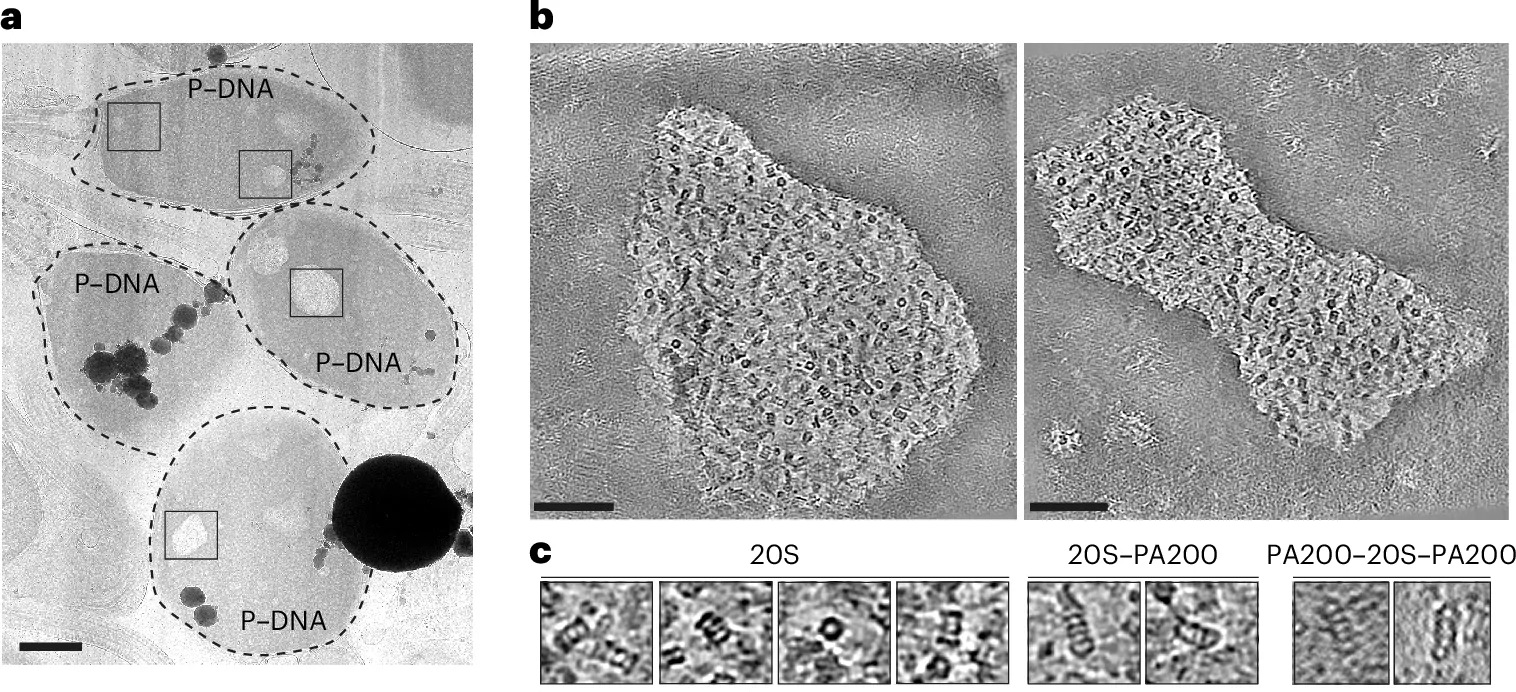 Nuclear lacunae in human sperm cells are proteasomal compartments. a, Cryo-EM low-magnification lamellae map showing four human sperm heads. Rectangles indicate regions with sperm lacunae targeted for tilt-series acquisition. The image is representative of >8 independent experiments, using samples from >10 donors. Scale bar, 1 um. P-DNA, protamine-DNA. b, z slices from reconstructed tomograms showing barrel-shaped protein complexes inside membraneless nuclear compartments. Scale bars, 100 nm. c, Zoomed-in regions from tomograms showing barrel-shaped particles corresponding to 20S, 20S-PA200 and PA200-20S-PA200 inside lacunae. Scale bar, 100 nm.
