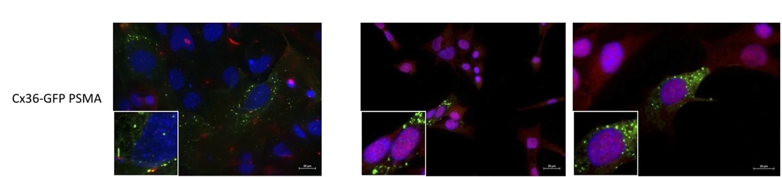 Bafilomycin-induced expression of degradation markers. Green - Cx36-GFP, red - specific marker (RAB11A, PSMA1, p62), blue - DAPI.