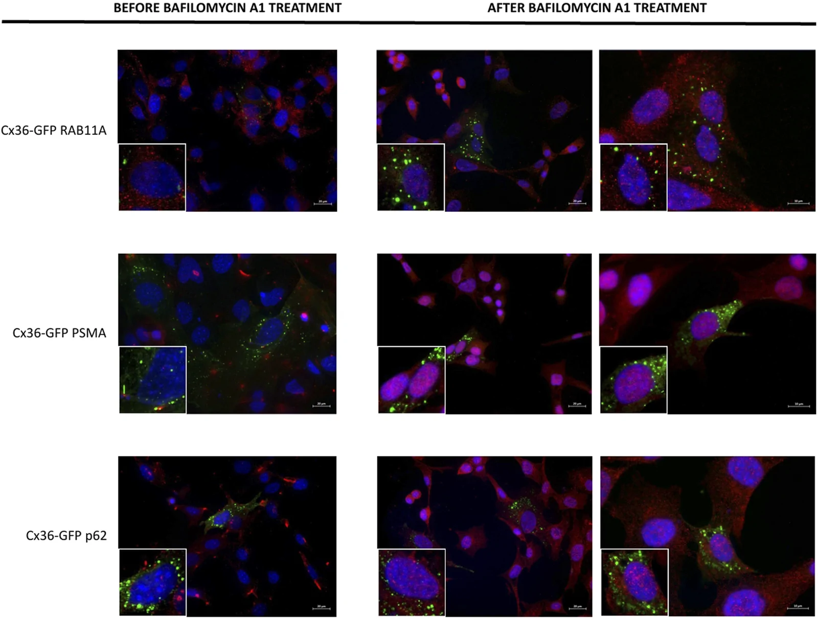 Bafilomycin-induced expression of degradation markers. Green - Cx36-GFP, red - specific marker (RAB11A, PSMA1, p62), blue - DAPI.