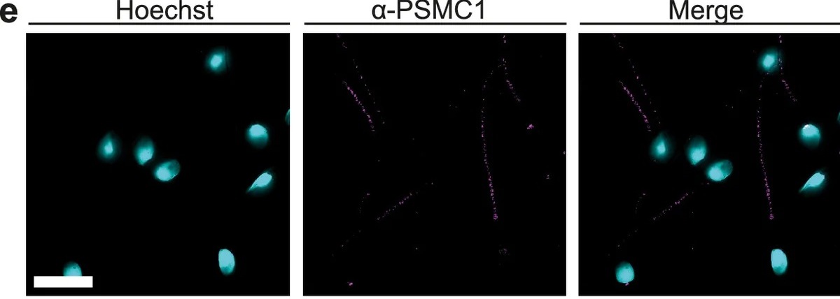 Proteasome distribution and clustering in mouse and human sperm cells. e , SIM image showing localisation of the AAA-ATPase subunit of 19S, PSMC1 (magenta) in the tail of human sperm cells. Scale bar = 10 um. Image is representative of >20 cells (2 biological replicates).