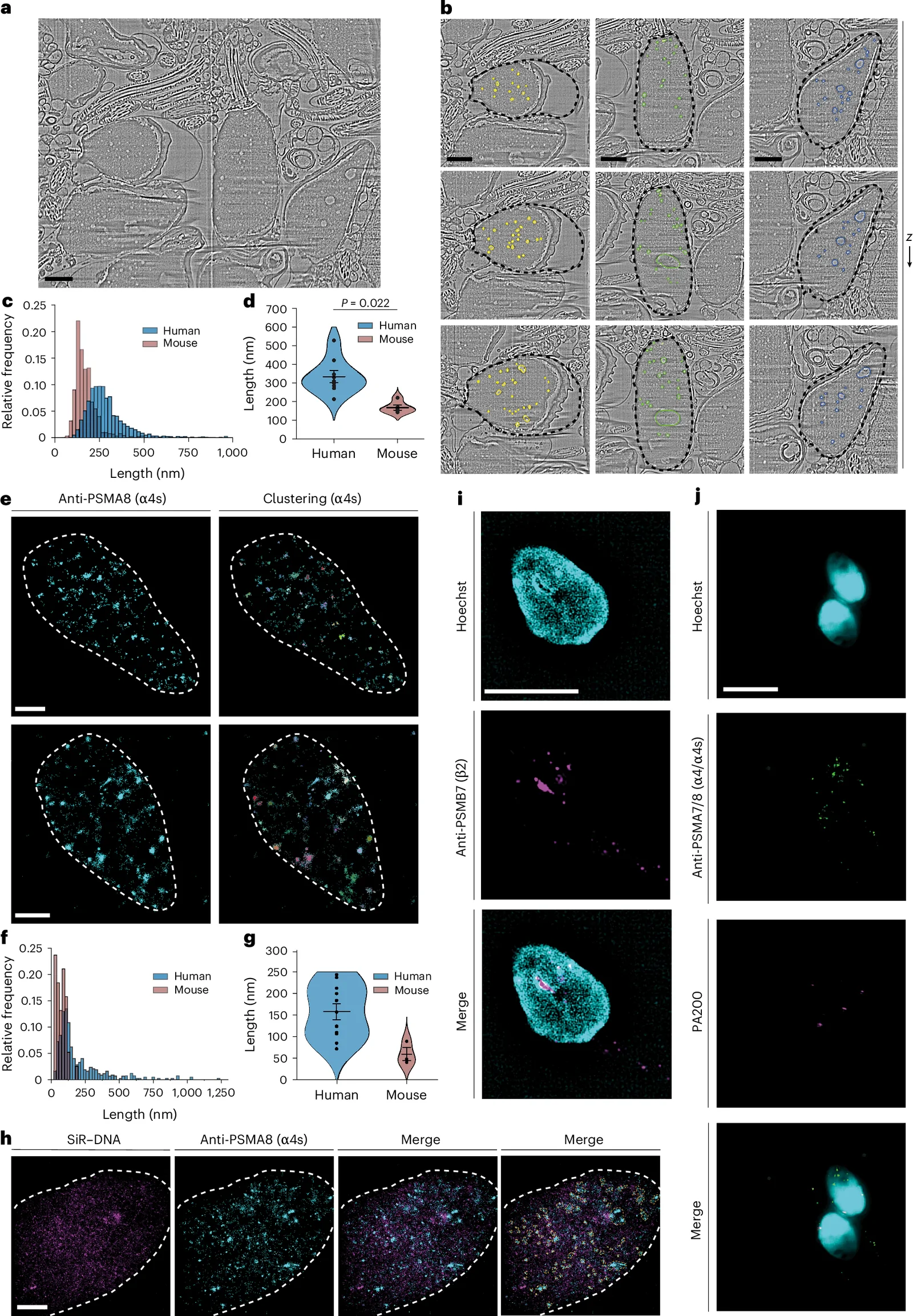 Human sperm nuclear lacunae are variable in size and positive for proteasomes with testis-specific subunit PSMA8, which segregates from DNA. a, A z slice of 3D reconstructed cryo-SEM volumetric data of human sperm cells. Sperm lacunae are visible in the nucleus. Scale bar, 1 μm. b, Detail of three human sperm heads from volumetric data shown in a. Segmented lacunae are shown in color (yellow, green and blue) at three different z heights. The sperm nucleus is shown in dashed black lines. Scale bars, 1 μm. c, Relative frequency plot of the Feret diameters of segmented human sperm lacunae (blue) and comparison to values from mouse data (red). d, Violin plots for data shown in c. e, STORM of sperm-specific proteasome subunit α4s (PSMA8) in human sperm cells. The white dashed line shows the sperm nuclear region. Right: α4s cluster identification following DBSCAN analysis of α4s within nuclear region. f, Histogram of α4s clusters identified using STORM in human (blue) and mouse (red) cells. g, Violin plots for data shown in f. h, STORM imaging of DNA and α4s in a human sperm cell, using SiR–DNA and immunofluorescence staining against α4s. Regions of α4s density segregated from DNA are shown within dashed yellow lines in the rightmost panel. Scale bar, 1 μm. i, SIM showing proteasome subunit PSMB7 (β2) forming foci in the nucleus of sperm cells (magenta) in regions of no DNA staining (Hoechst). Scale bar, 5 μm. j, SIM imaging of human sperm cells showing nuclear foci of α4/α4s (PSMA7/8) proteasome subunit (green) and partial colocalization with PA200 (magenta). Small α4/α4s foci were also present in the tail. Scale bar, 5 μm.