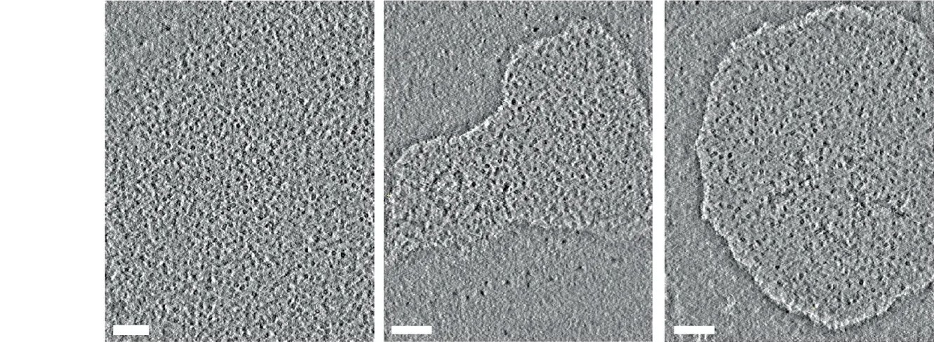 Gallery of lacunae and subtomogram averaging processing pipeline of nuclear sperm proteasomes. a, cryo-tomographic slices from deconvolved tomograms of six nuclear lacunae filled with barrel-shaped proteins. Scale bar = 100 nm. b, Details of the subtomogram averaging processing pipeline of 20S, 20S-PA200 and PA200-20S-PA200 proteasomes. Subtomogram averages with fitted PDBs are shown. c, Gold-standard Fourier Shell Correlation (FSC) curves for the Subtomogram Averaging (STA) maps: 20S, 20S-PA200 and PA200-20S-PA200. The resolution values at FSC = 0.143 (half-map FSC) are indicated. (human (sperm cell nuclear lacunae); Extended Data Fig. 1, a (cryo-tomographic slices, six nuclear lacunae; rows 31-517, cols 41-1371 of figure).)