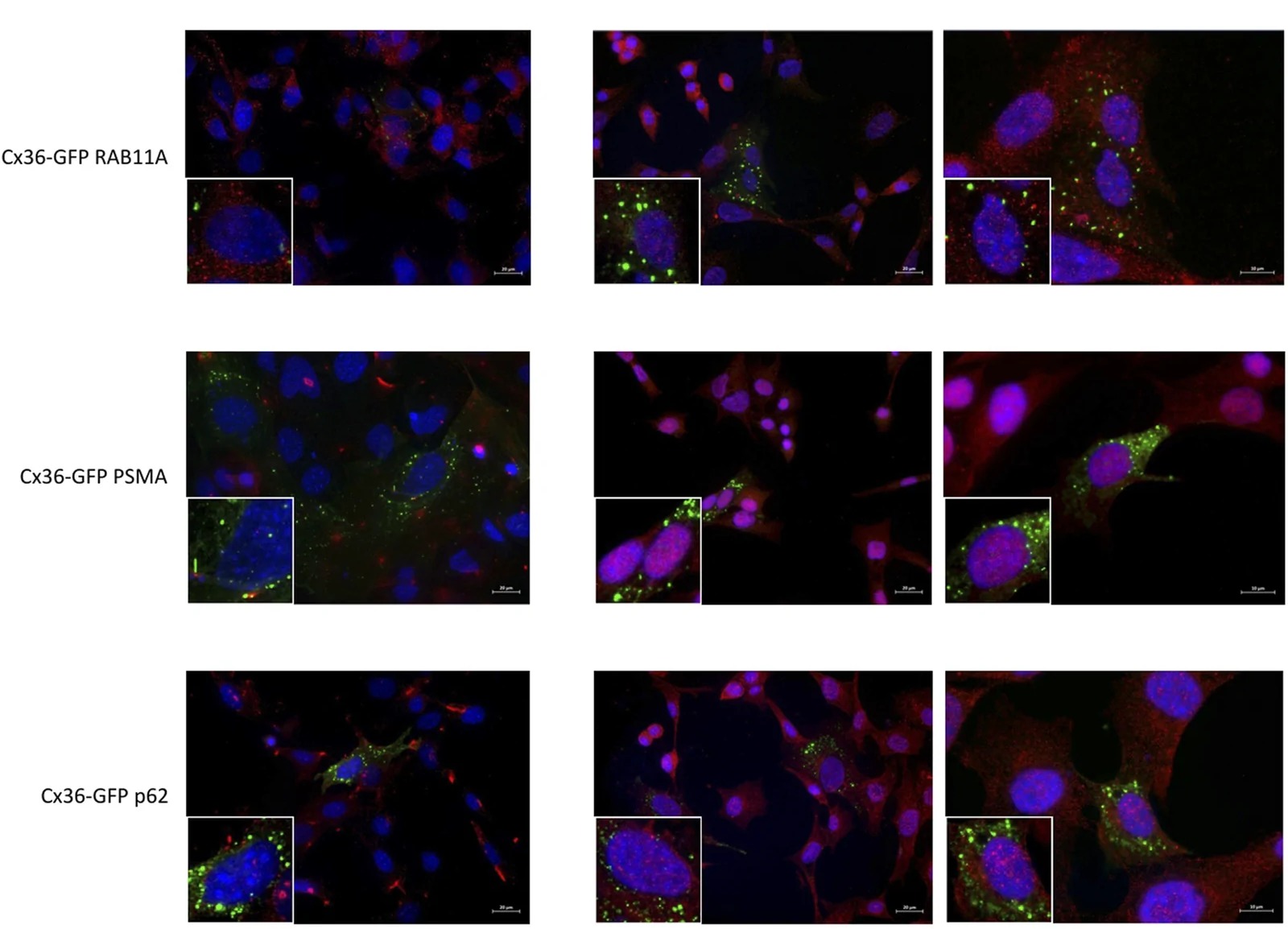 Bafilomycin-induced expression of degradation markers. Green - Cx36-GFP, red - specific marker (RAB11A, PSMA1, p62), blue - DAPI. (mouse (661W photoreceptor cells, Cx36-GFP transfected); FIGURE 5, full figure (three-row IF panel showing RAB11A, PSMA1, and p62 co-staining with Cx36-GFP; white header trimmed).)