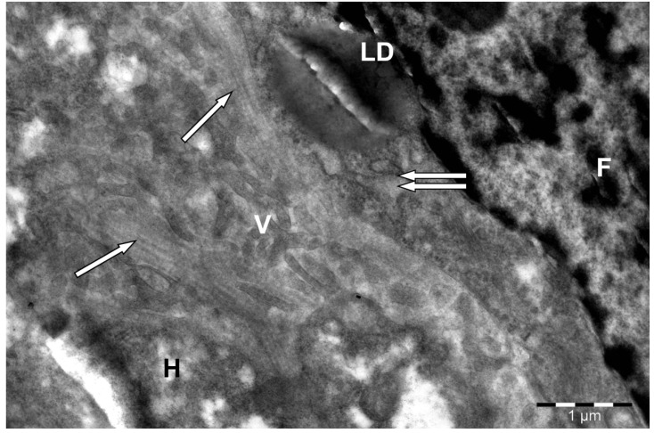 Sinusoidal side of a hepatocyte (H) in camel liver. F--fibroblast; dilated channels of the granular endoplasmic reticulum (↑↑); LD--lipid droplet; V--hepatocyte villi; collagen fibers (↑) in the perisinusoidal space of Disse. Electron microphotography. (Bactrian camel (Camelus bactrianus, liver hepatocyte); Figure 5single.)