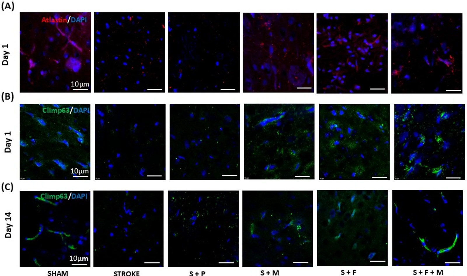 Representative immunofluorescence images showing expression of (A) Atlastin at Day1, (B) Climp63 at Day1, (C) Climp63 at Day14 in the cortical penumbral brain region in different groups (Atlastin: Red, DAPI: Blue; Climp63: Green). Adapted: IF panels A, B, and C only; quantification bar graph panels D, E, and F excluded. (rat (cortical penumbral brain region, post-stroke IA-MSC treatment); Fig. 8, panels A, B, and C (IF panels for Atlastin and Climp63; quantification panels D-F excluded; rows 10-955 of full figure, 1600x945).)
