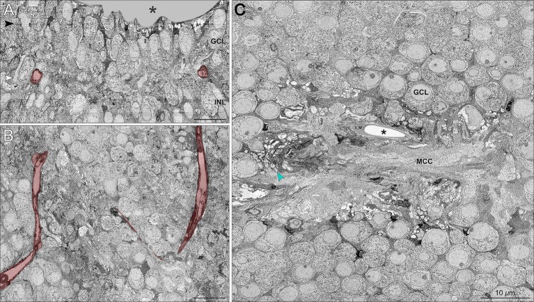 Human foveal retina volume EM: Müller cell cone and retinal neurons in the foveal avascular zone. Vertical section showing cone photoreceptor cell bodies (inner nuclear layer), connecting cilia, and outer segment bases. Müller glia processes ensheathing cone somata are visible. Adult human donor born pre-term. (Homo sapiens; Figure 1.)