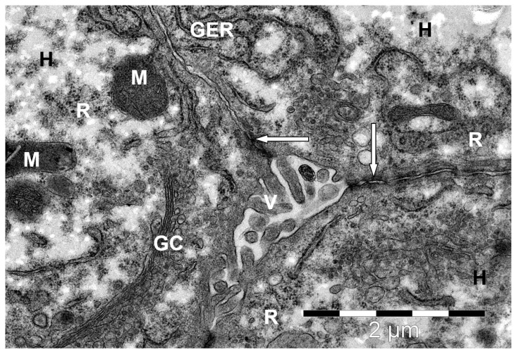 Bile canaliculi with villi (V) on the biliary side of a camel liver hepatocyte. H--hepatocyte; desmosomes (↑); GC--Golgi complex; M--mitochondria; GER--granular endoplasmic reticulum channels; R--ribosomes and polyribosomes. Electron microphotography. (Bactrian camel (Camelus bactrianus, liver hepatocyte); Figure 6single.)