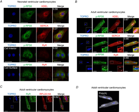 Ribosomes are localized throughout the neonatal and adult ventricular myocyte ER and SR membrane network. A, coimmunofluorescence labelling of neonatal rat ventricular myocytes or (B) adult rat ventricular myocytes with antibodies to the S6 ribosomal protein phosphorylated at Ser 235/236 (p-RPS6) and either an antibody that specifically recognizes proteins containing the KDEL sequence, used as an ER marker, the Ca2+-ATPase of the SR (SERCA), or the cardiac ryanodine receptor (RyR2). C, coimmunofluorescence labelling of isolated adult ventricular myocytes from RiboTag mice, expressing hemagglutinin (HA)-tagged ribosomal protein RPL22, which is incorporated into actively translating polyribosomes. TOPRO, nuclei; scale bars = 20 µm. D, mRNA fluorescence in situ hybridization (FISH) of poly(A)-mRNAs in adult rat cardiac myocytes.