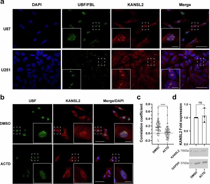 Nucleolar localization of KANSL2. a Immunofluorescence detection of endogenous KANSL2 and nucleolar markers UBF in U87 and FBL in U251 cells. A dashed box corresponding to the zoomed area is shown in greater detail (scale bars: 50 um and 10 um for insets). b Actinomycin D (ACTD) treatment of U87 removed KANSL2 and relocalized UBF immunofluorescence signals from nucleolus. DAPI was used to stain the nucleus.