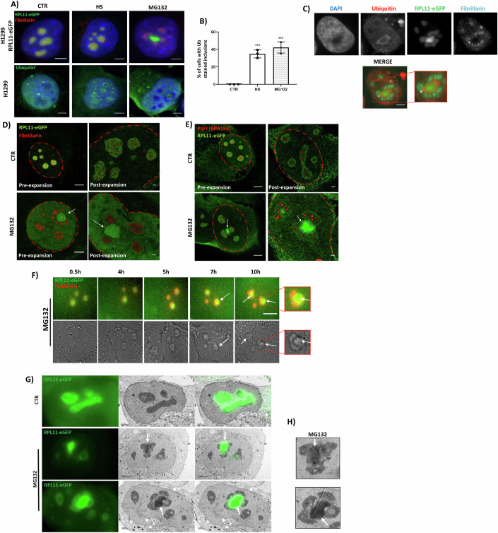 Reorganisation of the nucleolus upon stress and the generation of nucleolus-related inclusions. (A) H1299 cells stably expressing RPL11-eGFP (top) and parental H1299 cells (bottom) were stressed with HS (2 h, 43 C) or MG132 (5 uM, 15 h) before being stained for fibrillarin (red, upper part) or ubiquitin (green, lower part). Nuclei are stained with DAPI (blue). Scale bar 5 um.