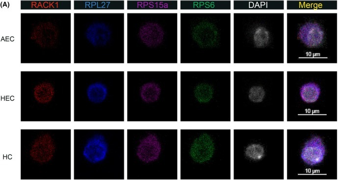 Quantitative analysis of ribosomal protein expression by immunofluorescence. (A) Representative immunofluorescence images showing subcellular localization of RACK1, RPL27, RPS15a and RPS6 in AECs (CD41- CD43- CD45- CD31+ CD201- Kit- CD44+), HECs (CD41- CD43- CD45- CD31+ CD201+ Kit+ CD44+) and HCs (CD45+ Kit+). Scale bars = 10 um.