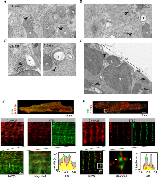 Ribosomes colocalize with the SR Representative electron micrographs of adult rat ventricular myocytes show ( A ) ribosome (arrowheads) association with perinuclear membranes (ER), ( B ) peripheral membranes (longitudinal, free SR), ( C ) T-tubules (near junctional SR) and ( D ) in the subsarcolemmal region, specifically at the terminal sarcolemma (TS) of intercalated disc (ID). M, mitochondria; T, T-tubules; N, nucleus. E , coimmunofluorescence imaging of phosphorylated ribosomal protein S6 (p-RPS6; red) and phospholamban (PLN; green) or ( F ) ryanodine receptor type 2 (RyR2) in isolated mouse ventricular myocytes using both confocal microscopy and STED nanoscopy. Zoomed-in images demonstrating the local association of p-RPS6 with individual PLN or RyR2. White rectangles indicate the orientation of the signal intensity profiling. Colocalized signals are indicated in yellow. White boxes in ( A ) and ( B ) indicate magnified regions. Scale bars: 10 µm (cell overview), 1 µm (confocal, STED) and 200 nm (magnified view). STED, stimulated emission depletion microscopy.